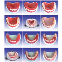 全口牙制作步骤模型