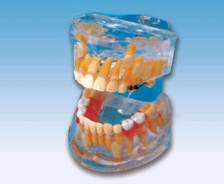 透明乳牙发育模型YR-L1009