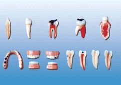 牙齿病变系列模型YR-L1012