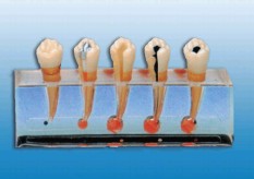 牙髓病临床模型YR-L1011