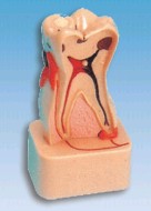 牙齿病变综合病理分解模型YR-L1004