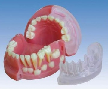 三岁乳恒牙交替解剖模型YR-L1021